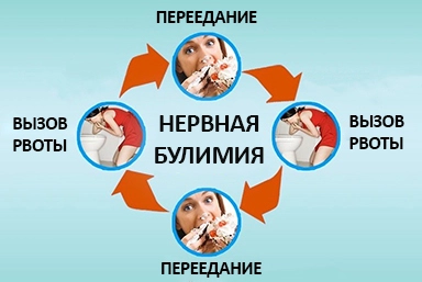 Лечение булимии в Приволжске